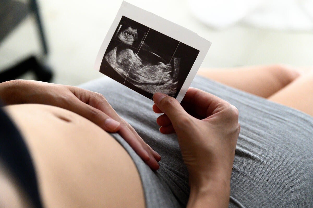 Doula Sprechstunde