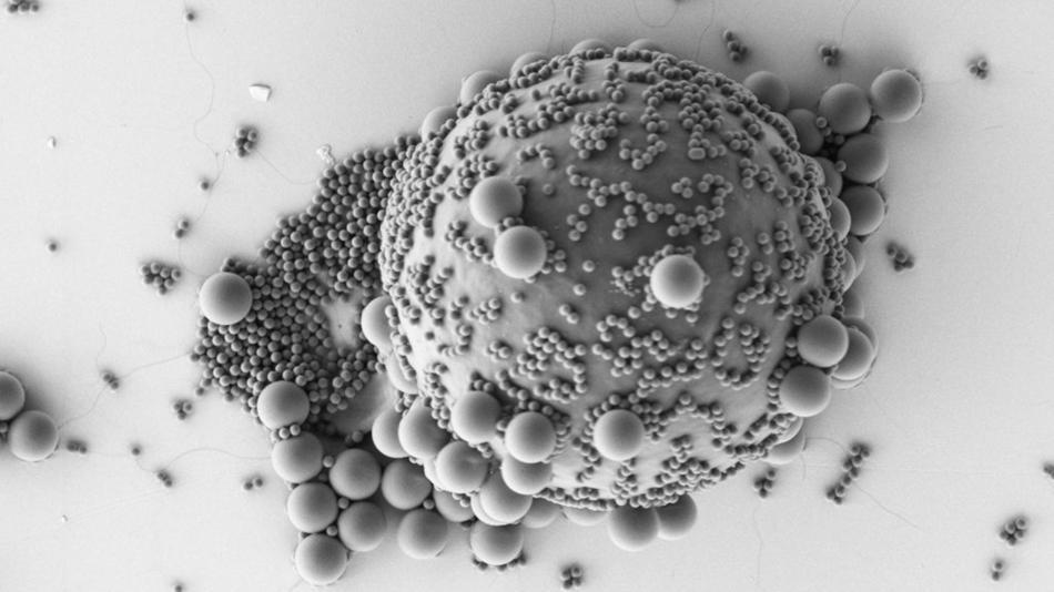 [LNF26] Einfluss von Mikroplastik: Wie nehmen wir Mikroplastik auf und welchen Einfluss hat es auf uns?