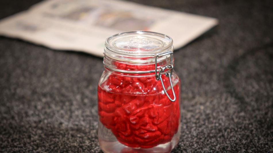 [LNF26] H02: Warum geht es dem Gehirn im Glas nicht gut?