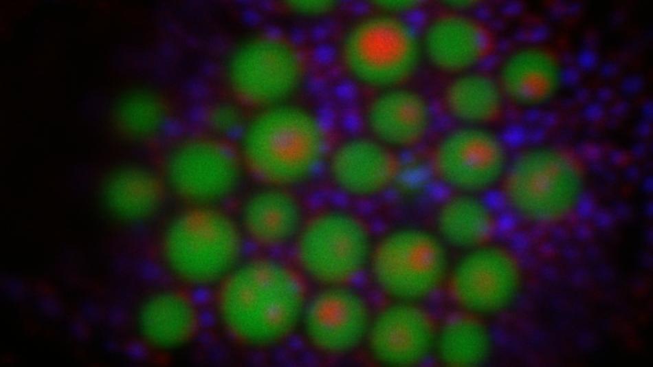 [LNF26] Vom Feind zum Helfer: Können Tabakpflanzen als Produktionsplattform für Biopharmazeutika dienen?