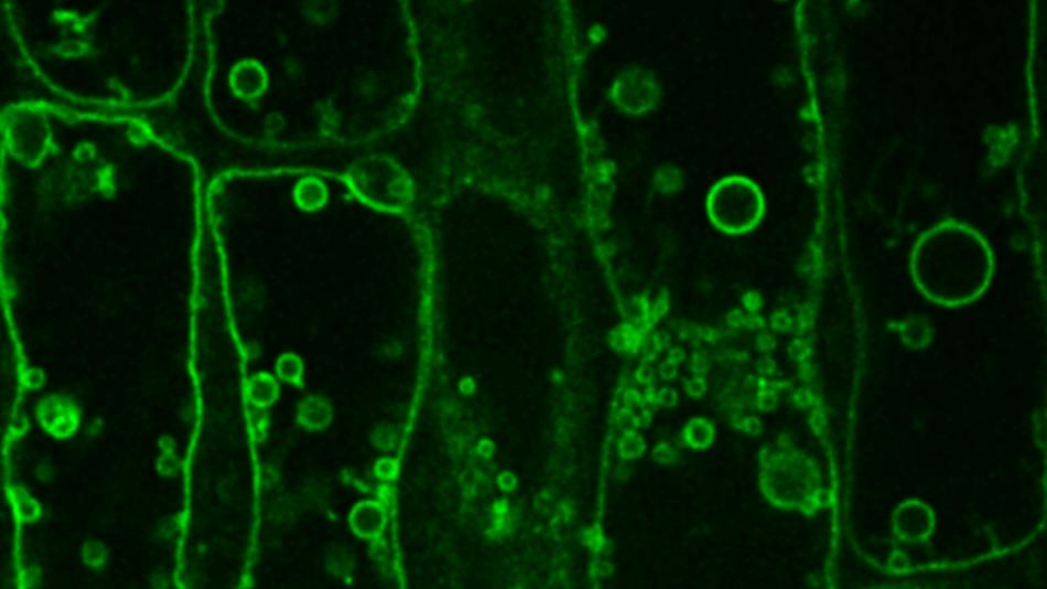 [LNF26] Why don't plant cells burst like overfilled balloons?