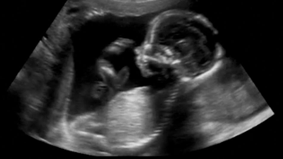 [LNF26] Was macht das Baby im Mutterleib?