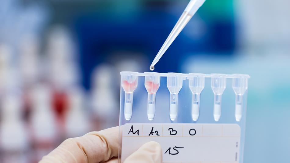 [LNF26] Wie funktionieren PCR Analysen und wie wird mit dieser Methode DNA vervielfältigt &amp; gemessen?