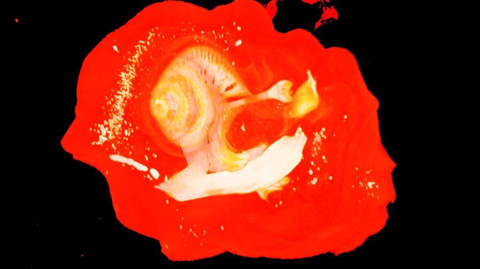 [LNF26] Innenohrforschung - wieso haben wir eine Schnecke im Ohr?