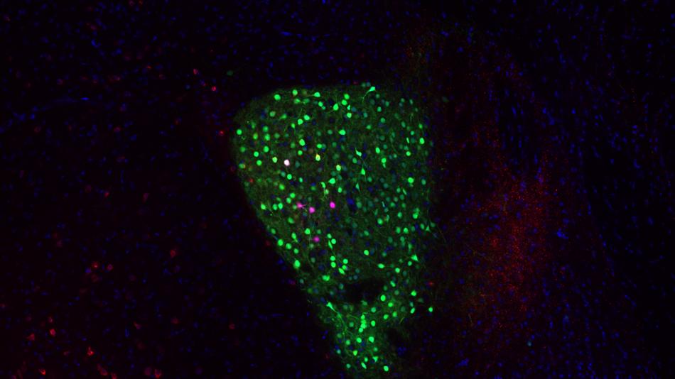 [LNF26] Vom Hirnschnitt zur fluoreszierenden Zelle
