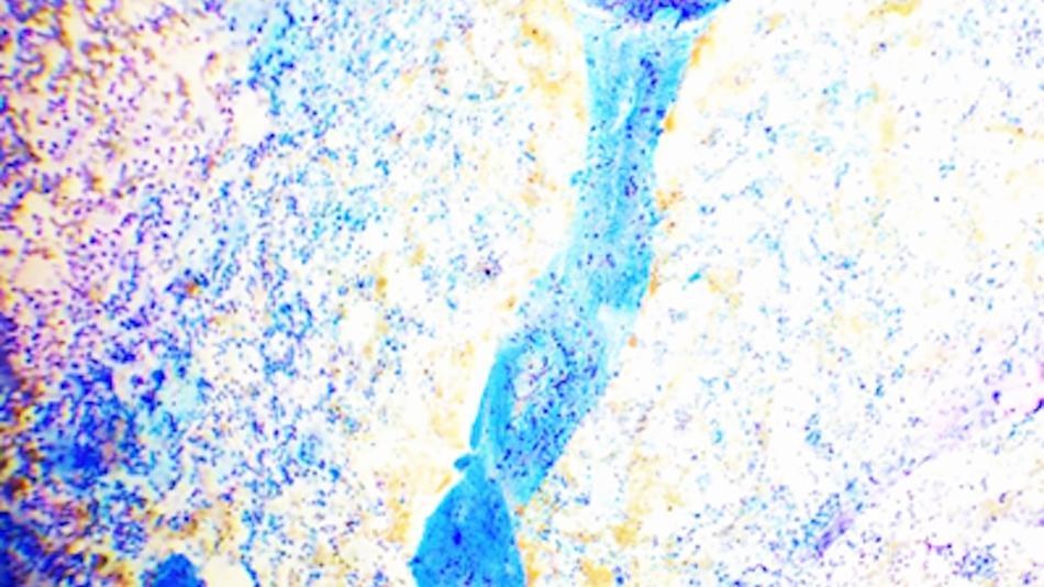 [LNF26] Was verrät Menstruationsblut über den Zyklus?