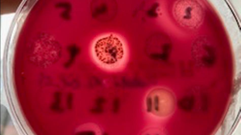 [LNF26] Mikrobiologie an der Universitätszahnklinik