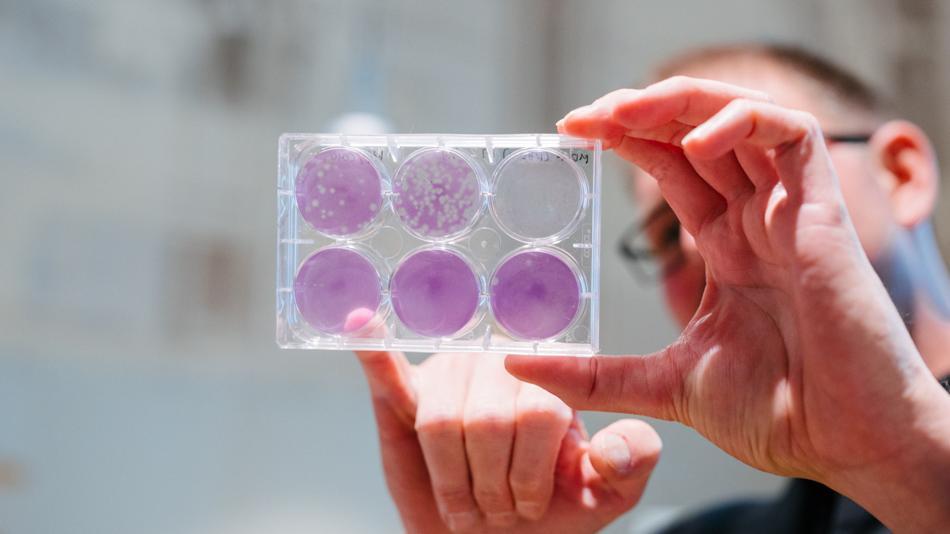 [LNF26] Virus-Detektiv:innen: Community Science