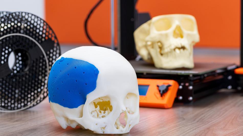 [LNF26] Wie können XR und 3D Printing in der Radiologie eingesetzt werden?
