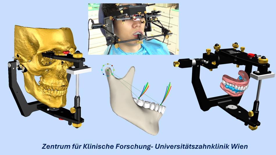 [LNF26] Klinische Forschung für Kiefergelenksdiagnostik